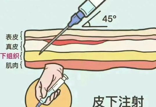 打针练习（打针教学视频1到9）