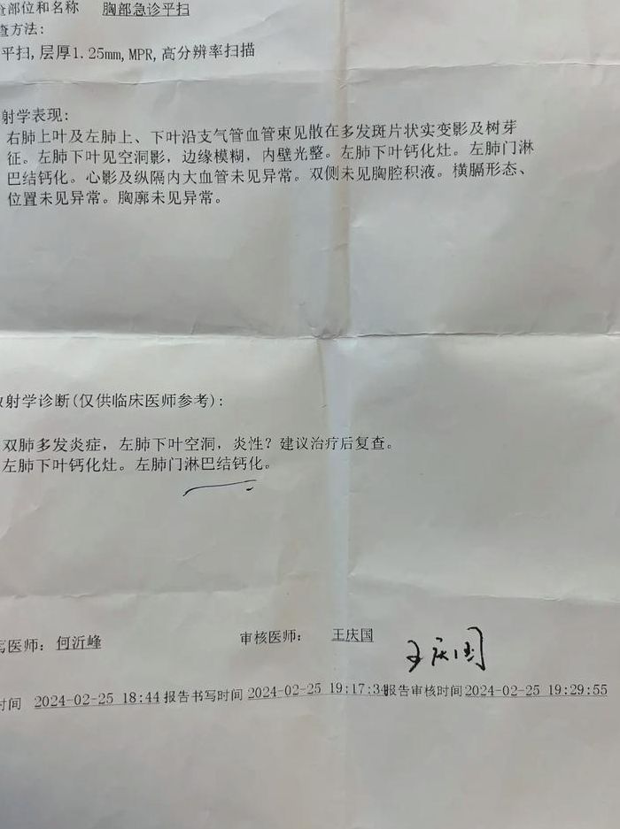 哈萨克斯坦出现不明原因肺炎（哈萨克斯坦确诊病例）