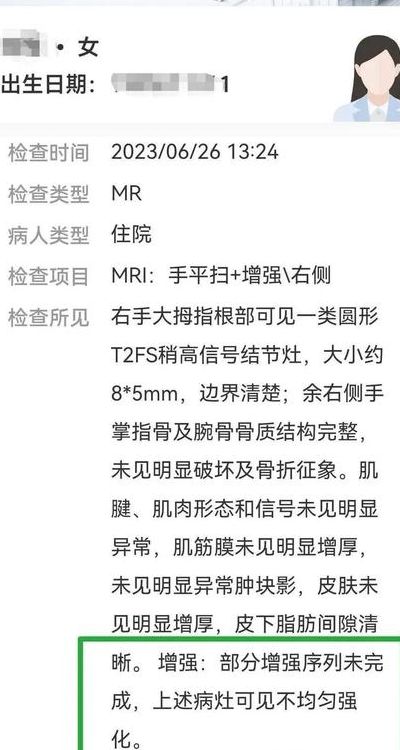 核磁共振可以医保报销吗（做核磁共振报告单要多久出来）